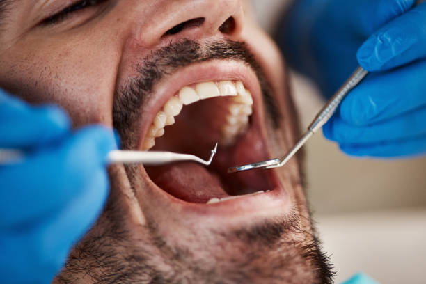 Best Cracked Tooth Emergency Dentist  in Dearborn, MI